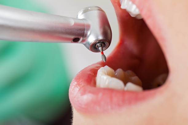 Best Chipped Tooth Repair Near Me  in Karns, TN